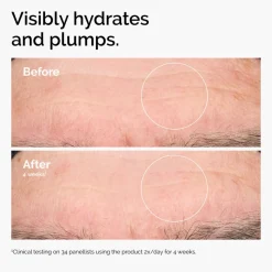 Hyaluronic Acid 2% + B5