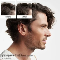 Nioxin System 2 Loyalty Kit