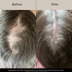 Pitta vækstserum - Vækstserum