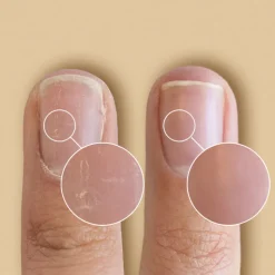 SolarOil Nail & Cuticle Treatment PEN